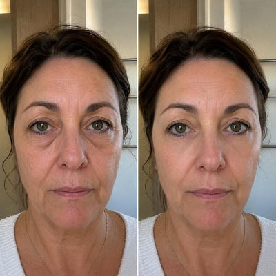 Marie L., 53 ans